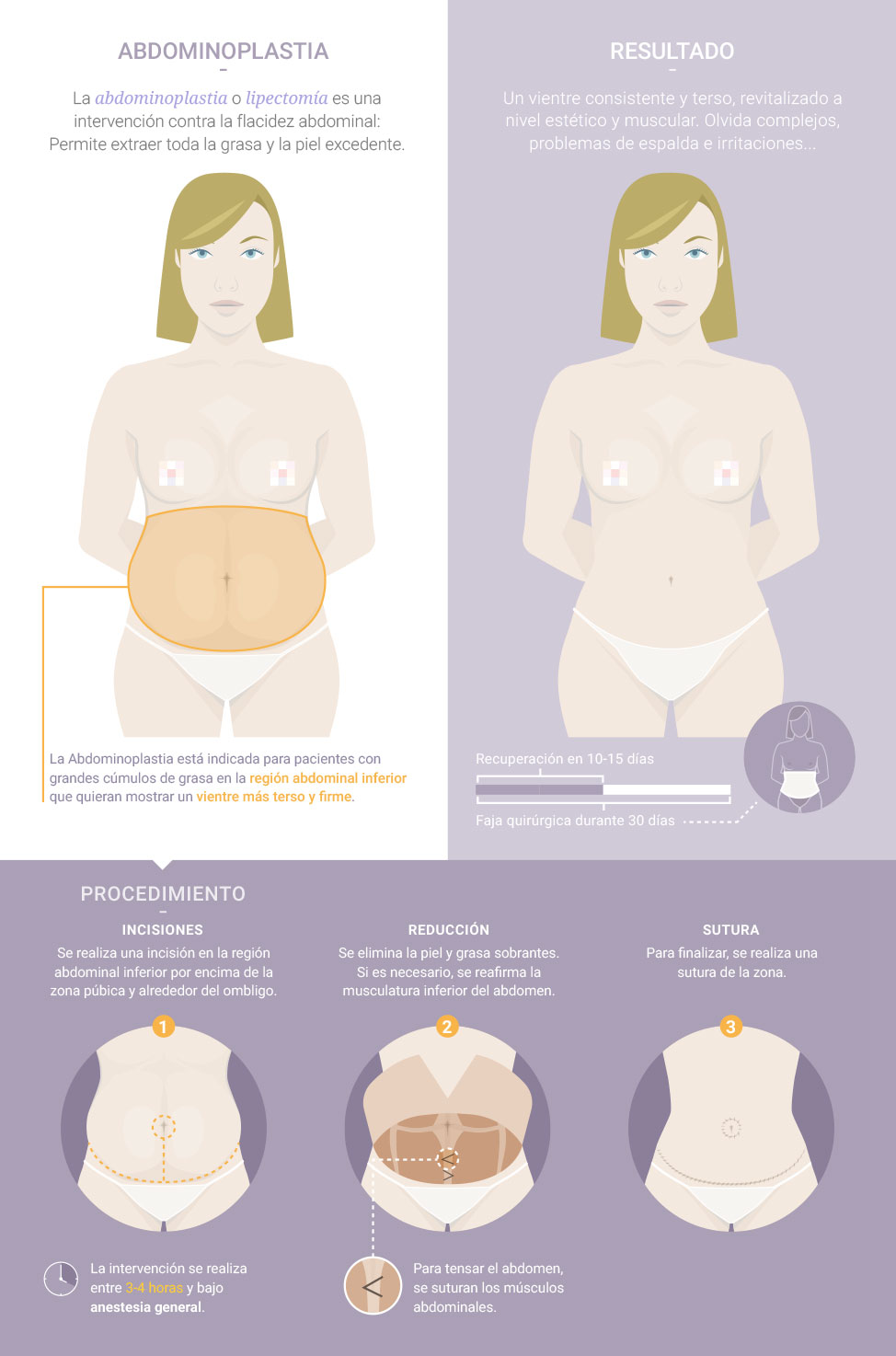 Abdominoplastia en Panamá para quitar la grasa abdominal