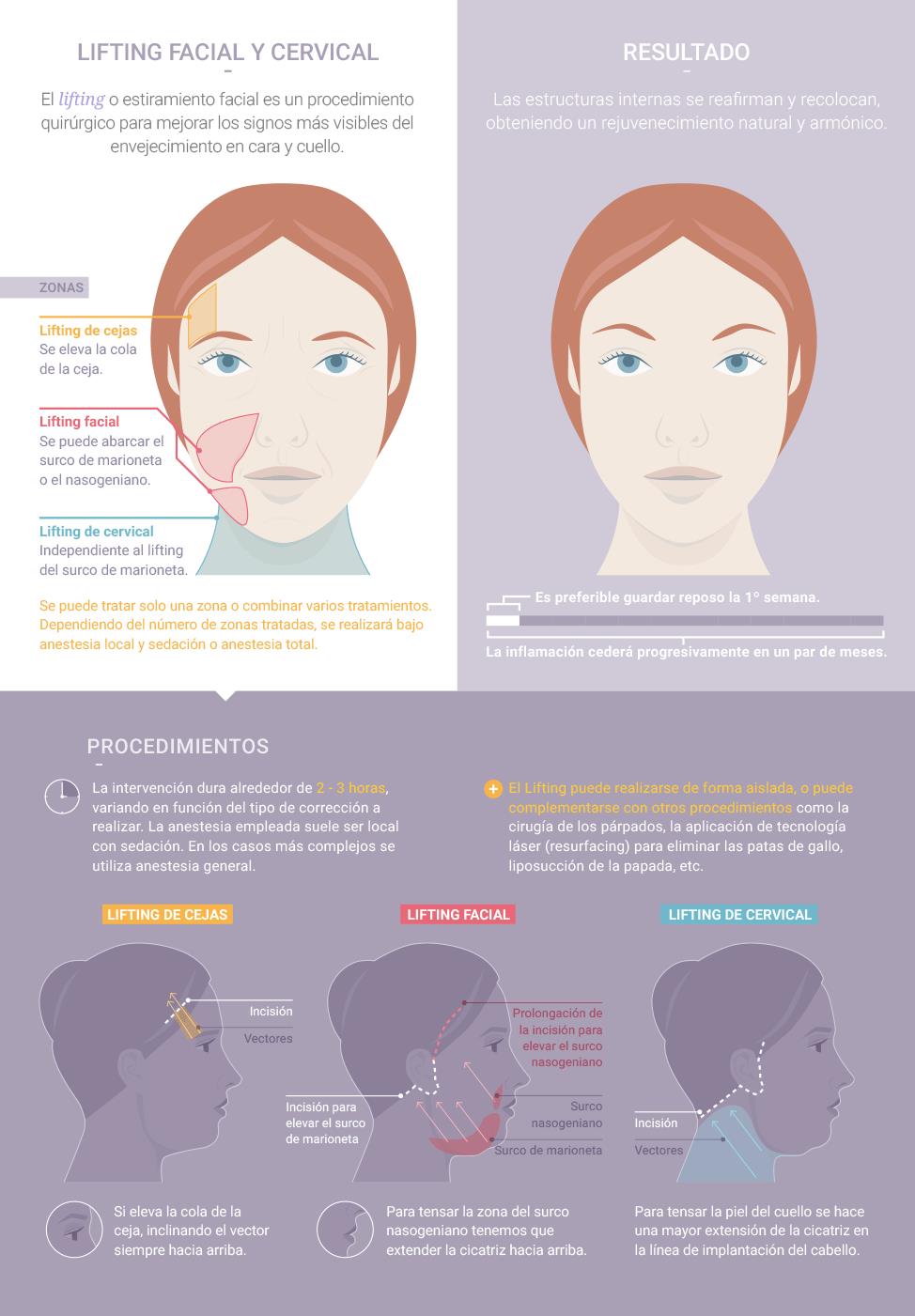 En qué consiste el lifting facial? Intervención y recuperación - Dr. Samir