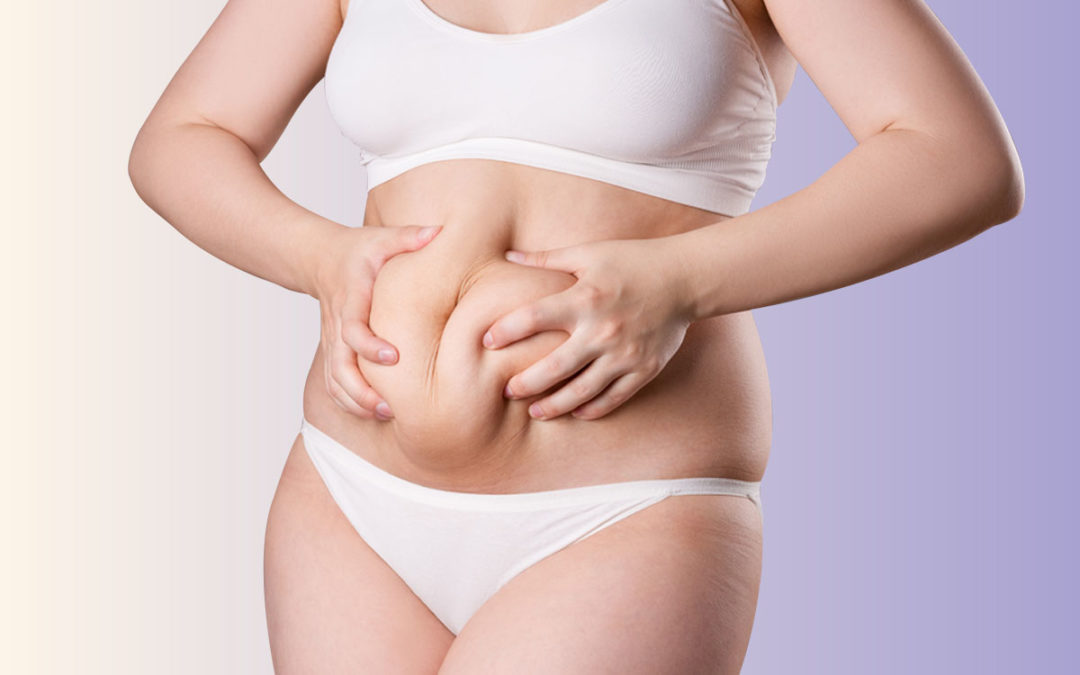 Abdominoplastia: Eliminación de Grasa - Clínicas Dorsia